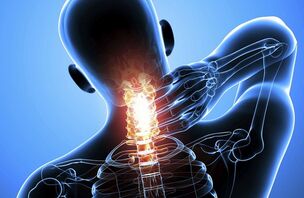 Dzemdes kakla osteohondroze