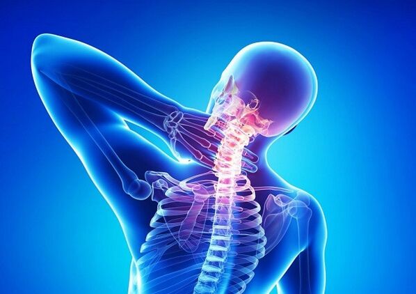 sāpes mugurkaula kakla daļā ar osteohondrozi